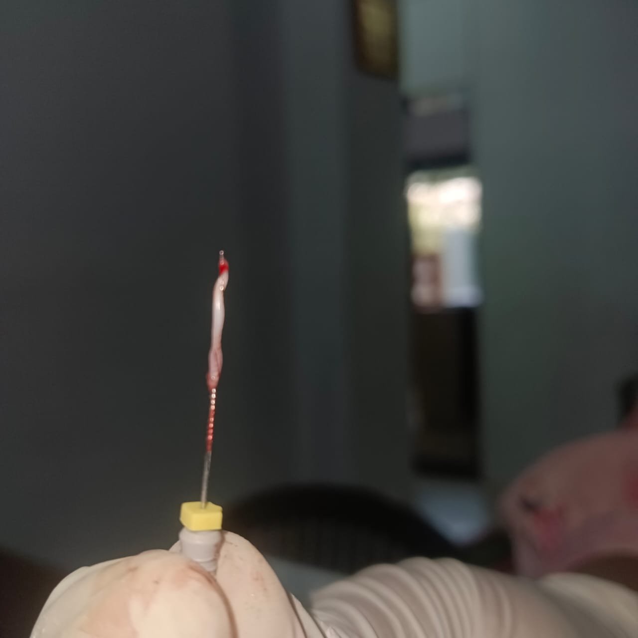 Extracted Dental Pulp